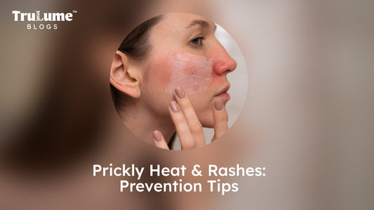 Prickly Heat and Rashes: Prevention Tips