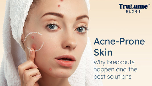 Acne-Prone Skin: Why Breakouts Happen and the Best Solutions