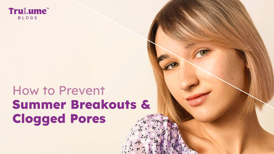 How to Prevent Summer Breakouts and Clogged Pores